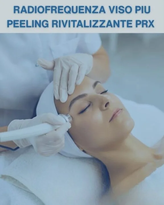 COUPON 17 Radiofrequenza viso piu’ peeling rivitalizzante con trattamento Prx
