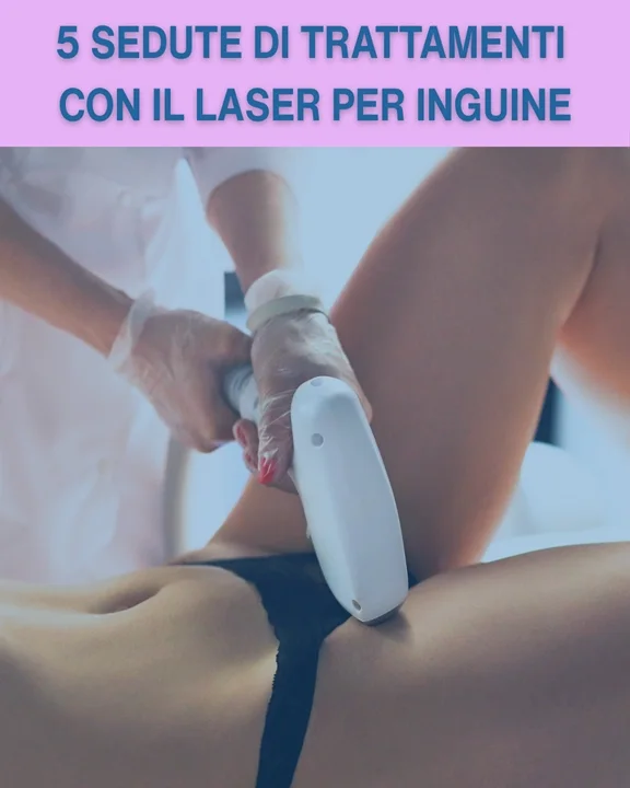 COUPON 56 Per 6 sedute di trattamenti con il Laser zona inguine