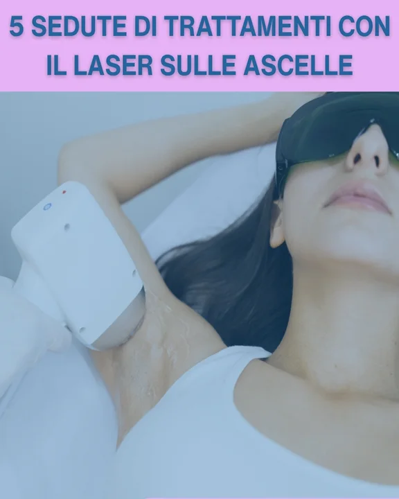 COUPON 79 Valido per 5 sedute di trattamento laser sulle zone delle ascelle