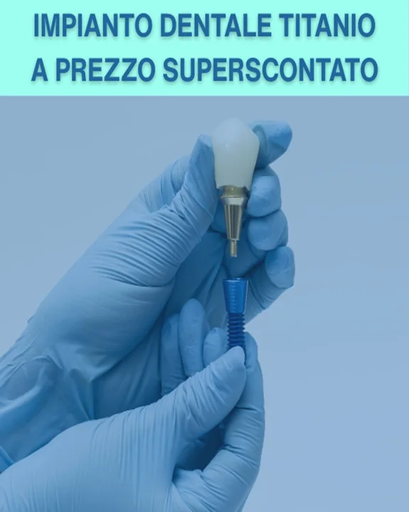 COUPON 63 Impianto dentale in Titanio a un prezzo superscontato