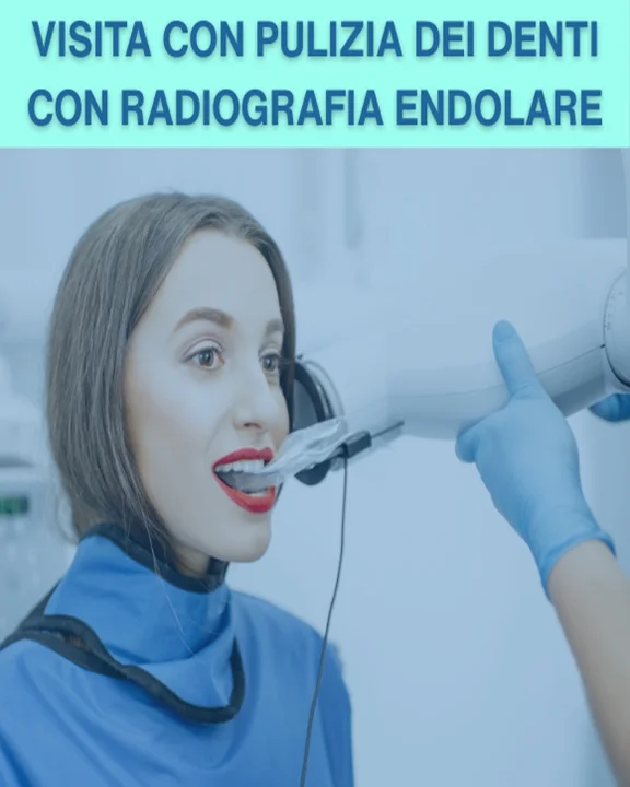 COUPON 83 Accurata visita con pulizia dei denti e controllo con Radiografia Endolare