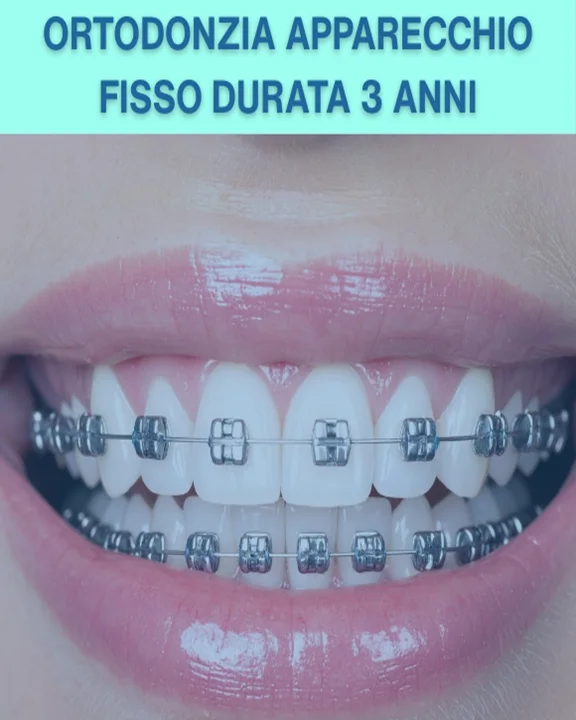 COUPON 46 Apparecchio dentale fisso garantito per una durata di 3 anni