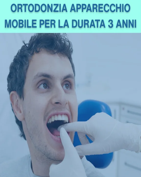 COUPON 88 Installazione Apparecchio dentale Mobile durata 3 Anni