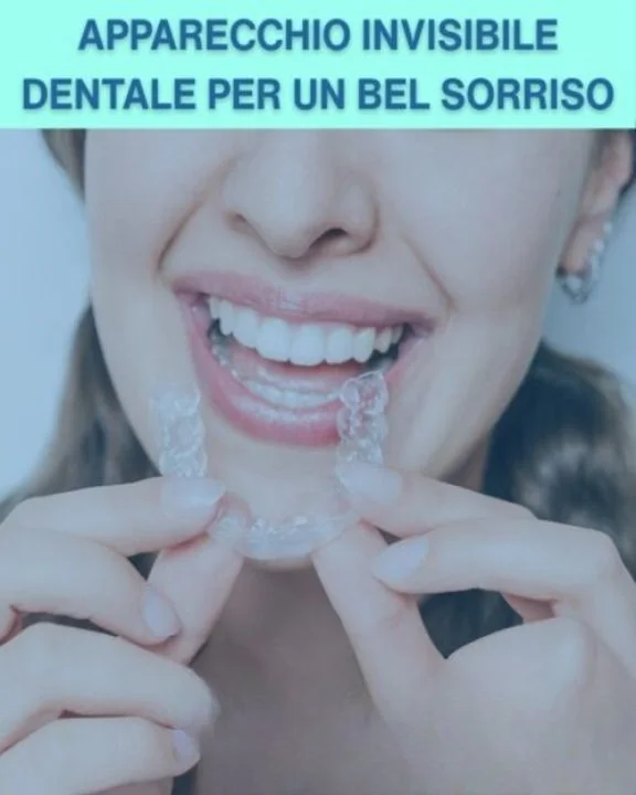 COUPON 24 Applicazione di apparecchio dentale per un bel sorriso
