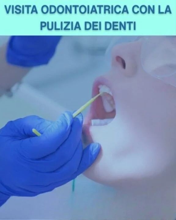 COUPON 31 Accurata e professionale visita odontoiatrica con Pulizia denti