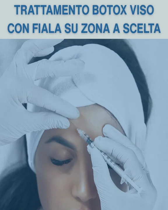 COUPON 77 Trattamento Botox con fiala su zona a scelta del viso